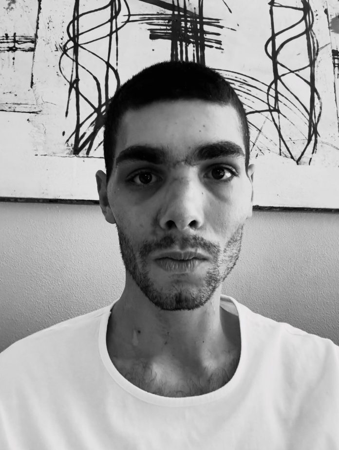 El desgarrador testimonio de un ciclista sobre las heridas que sufrió tras un impactante accidente: “Era un milagro seguir vivo”