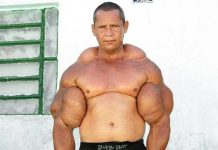 Murió “Popeye”, el fisicoculturista brasileño que se inyectaba aceite para tener unos bíceps de 73 centímetros