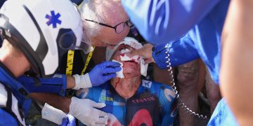 Escandaloso accidente en el Tour de France: un ciclista chocó contra un auto que frenó de golpe, recibió 20 puntos en el rostro y abandonó la carrera